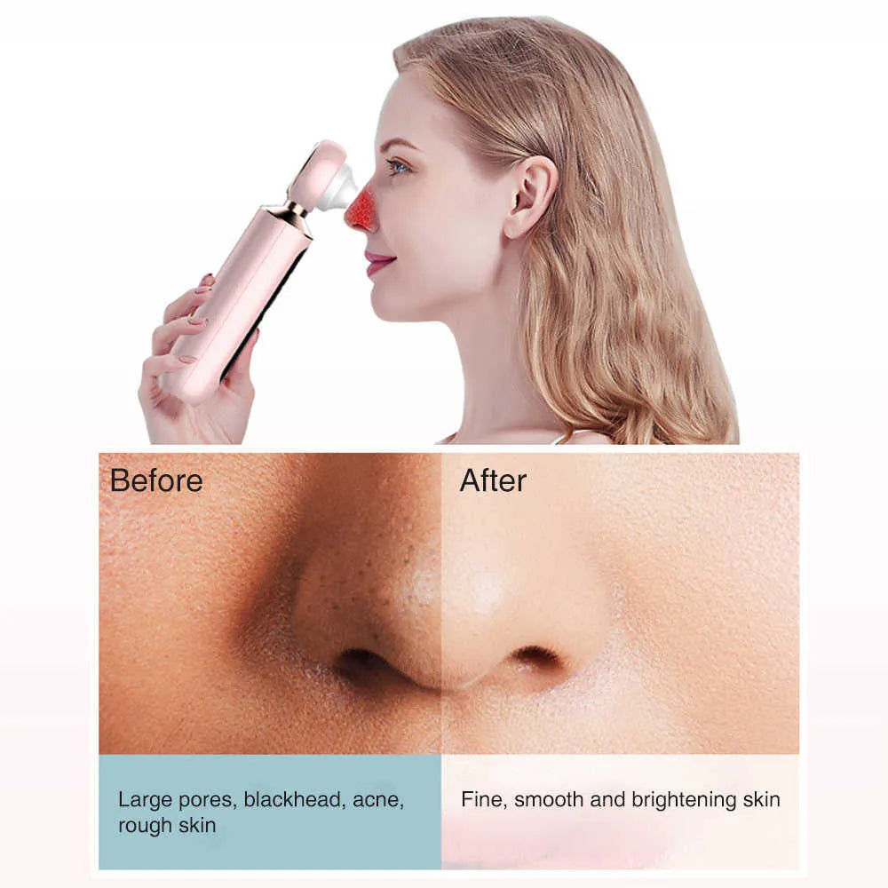 Arabia Glow™ Blackhead Suction Machine