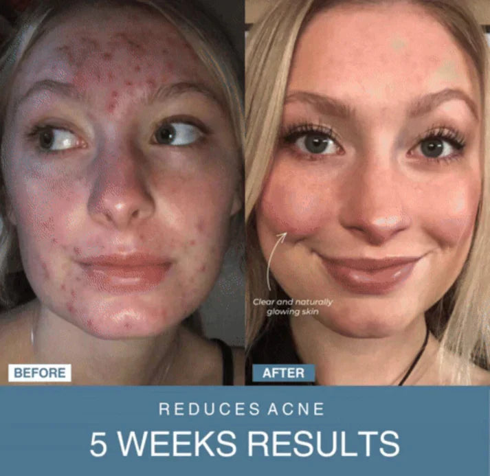 Arabia Glow™ 7-in-1 LED Anti-Aging/Wrinkle Apparatus