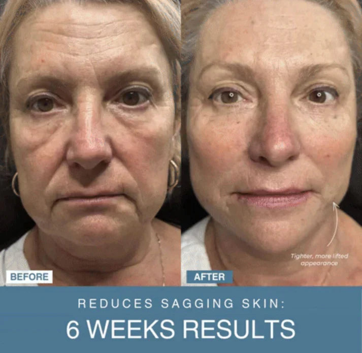 Arabia Glow™ 7-in-1 LED Anti-Aging/Wrinkle Apparatus