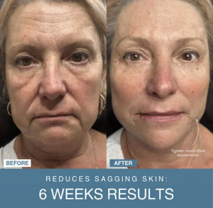 Arabia Glow™ 7-in-1 LED Anti-Aging/Wrinkle Apparatus